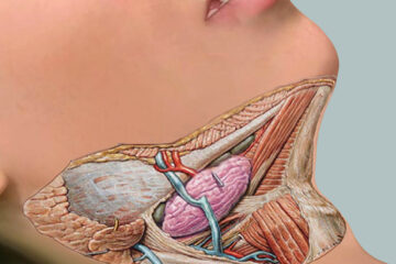 Cirugía de glándulas salivales