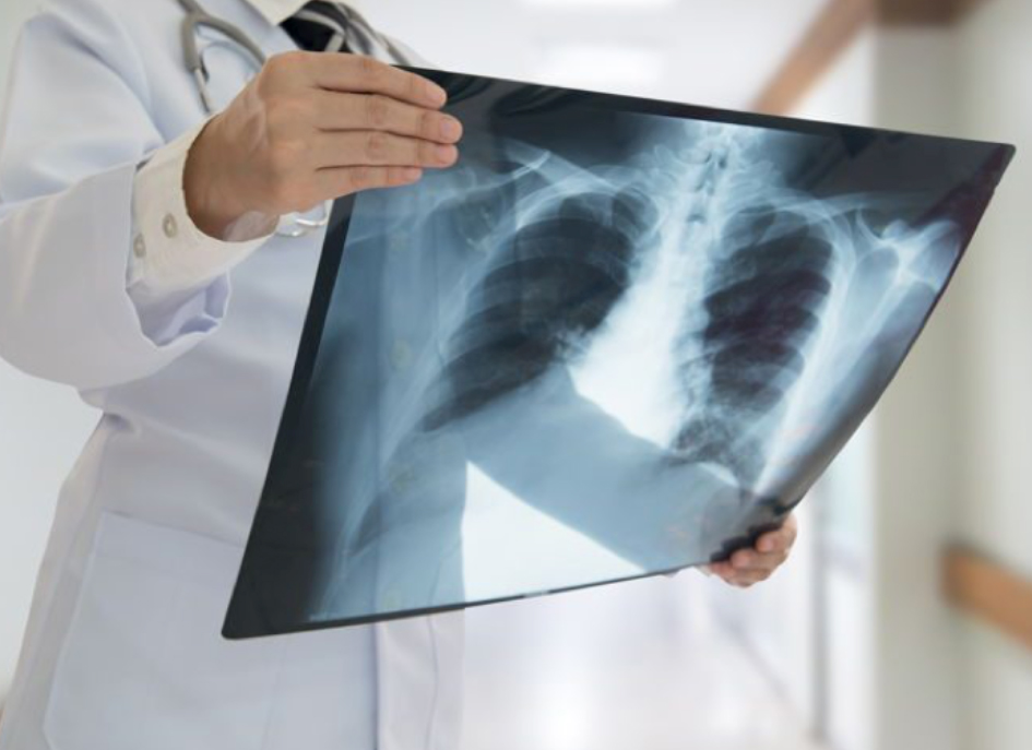 Una radiografía es una técnica de imagen que se utiliza para obtener imágenes de tejidos, órganos y huesos del interior del cuerpo humano.